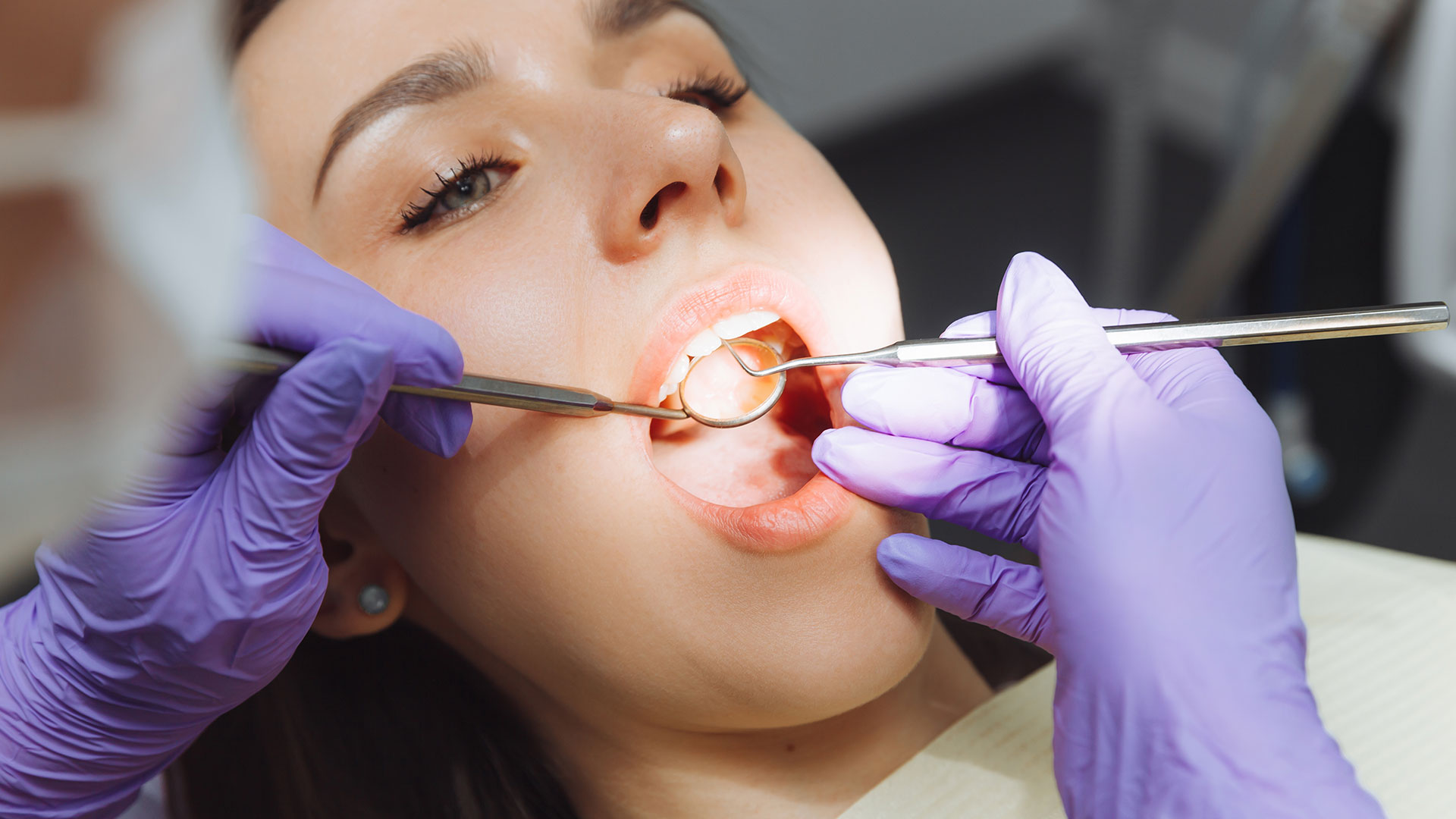 Tooth Extractions